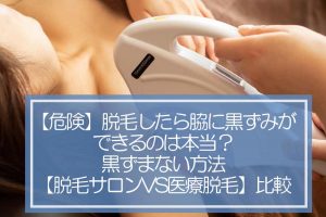 【危険】脱毛したら脇に黒ずみができるのは本当？黒ずまない方法【脱毛サロンVS医療脱毛】比較